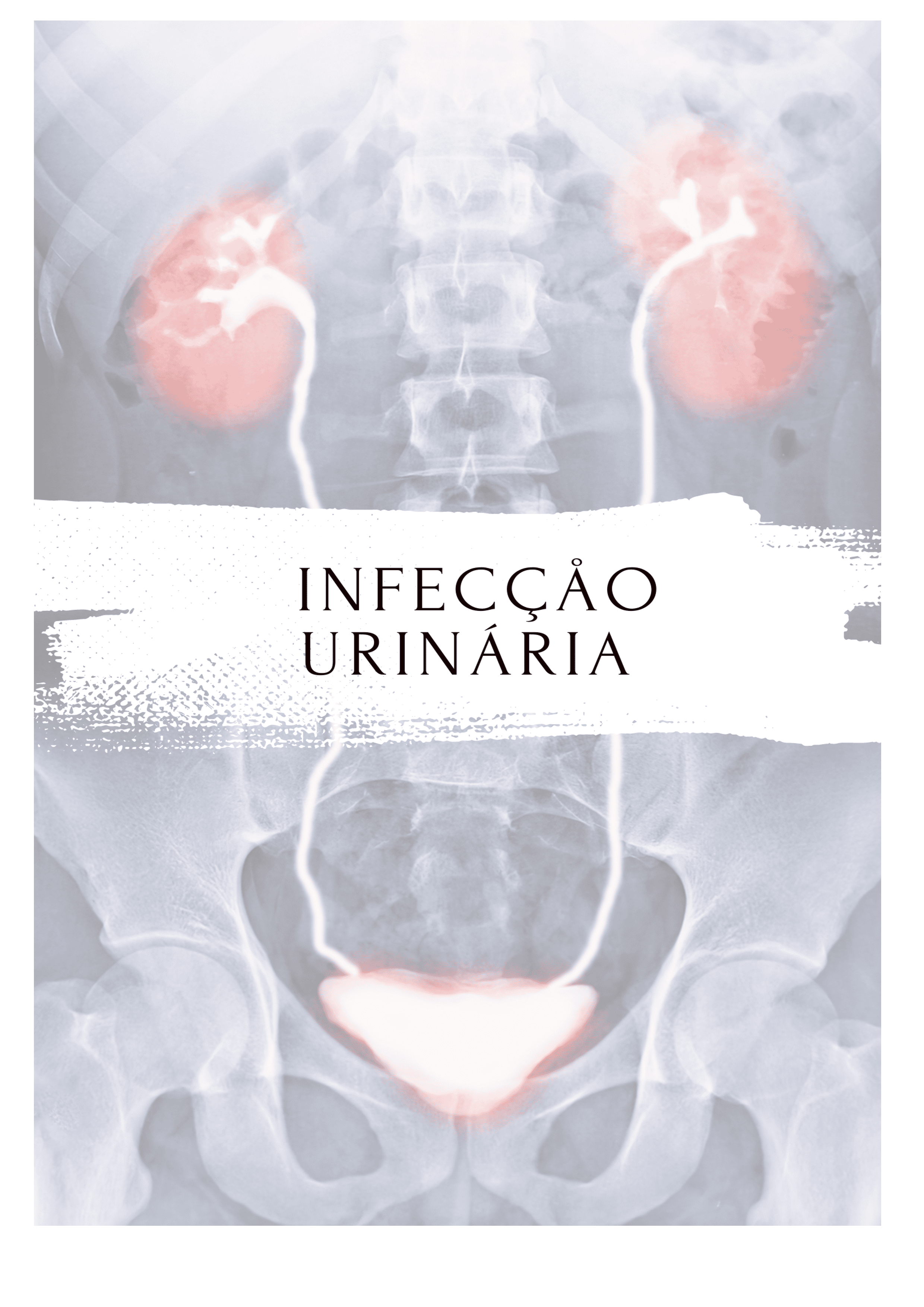 9Um_Guia_de_Raciocínio_para_Aprender_os_Antibióticos_Bizu_Farmacológico_63